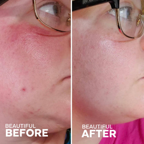 Three Ships Beauty - Radiance Grape Stem Cell + Squalane Cream (50g) - Home & Well