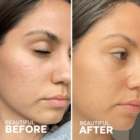 Three Ships - In The Clear 3 - Step Kit for Blemish - Prone Skin (3 full - size) - Home & Well