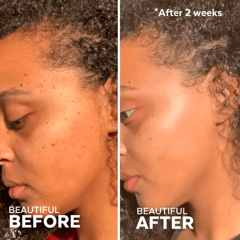 Three Ships - In The Clear 3 - Step Kit for Blemish - Prone Skin (3 full - size) - Home & Well