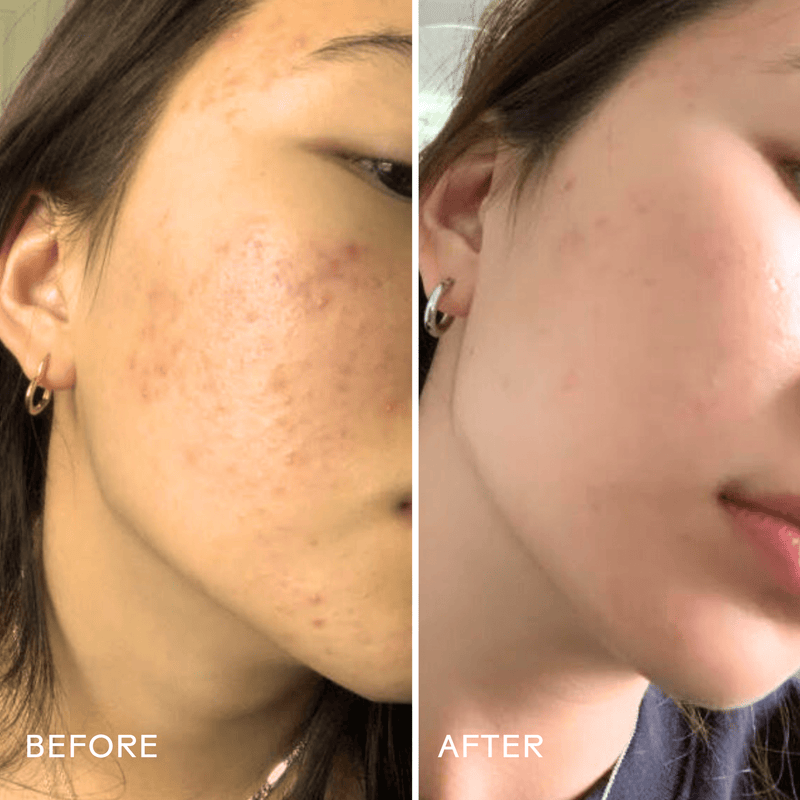 Three Ships - Purify Aloe + Amino Acid Gel Cleanser (118mL) - Home & Well